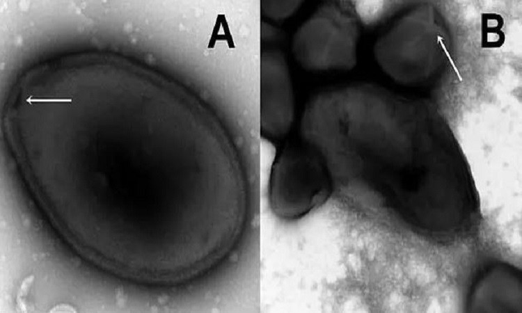 Virus Pandoravirus yedoma c&oacute; k&iacute;ch thước lớn, c&oacute; thể quan s&aacute;t được dưới k&iacute;nh hiển vi nhỏ. Ảnh: Daily Mail